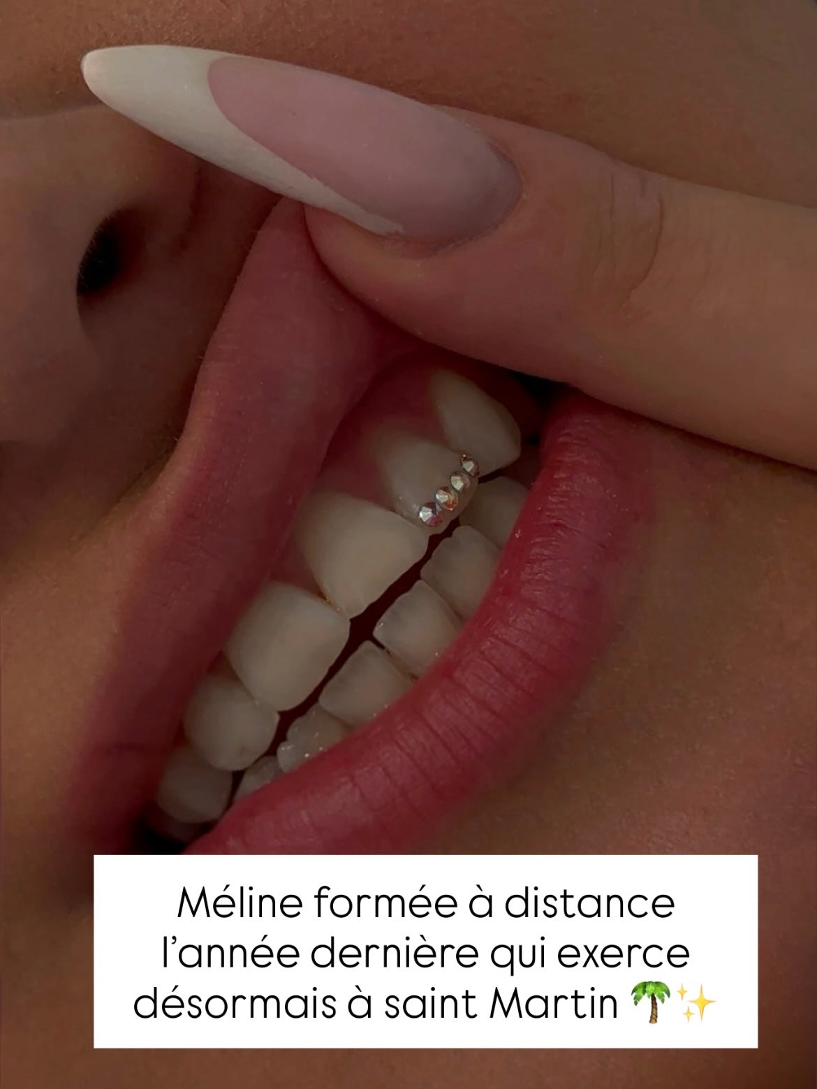 Formule strass dentaire avec kit inclus ( à distance)