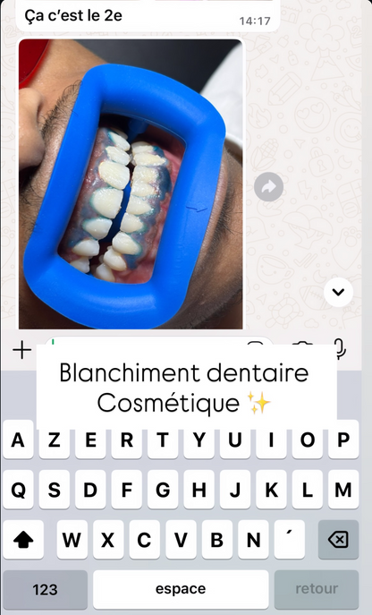 Pack 2 en 1 : blanchiment dentaire et strass dentaire + kit inclus (à distance )