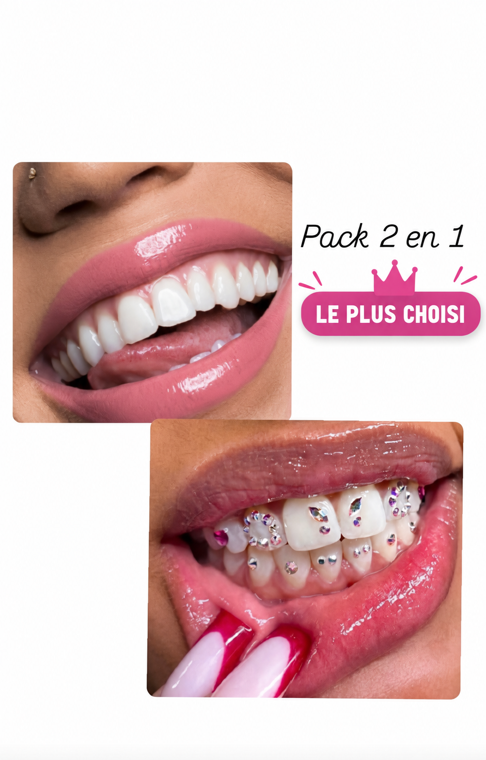 Pack 2 en 1 : blanchiment dentaire et strass dentaire + kit inclus (à distance )