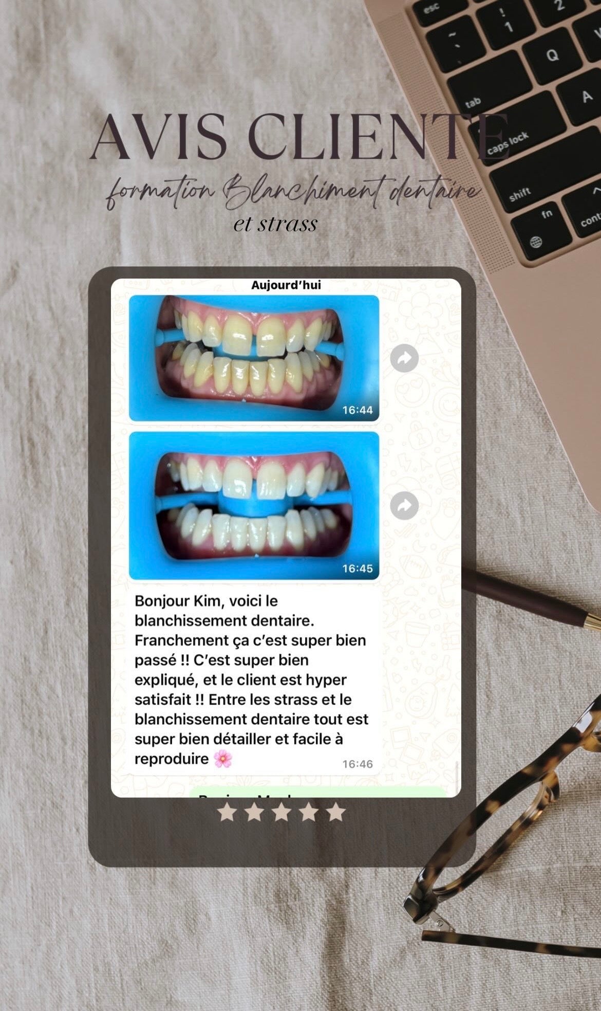 Pack 2 en 1 : blanchiment dentaire et strass dentaire + kit inclus (à distance )