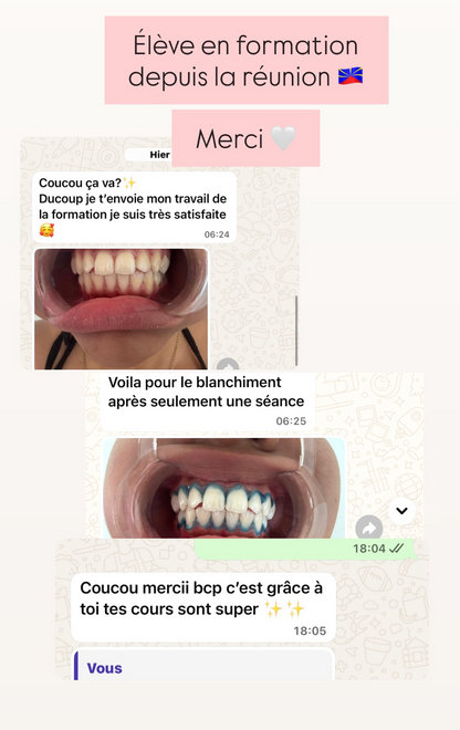 Pack 2 en 1 : blanchiment dentaire et strass dentaire + kit inclus (à distance )