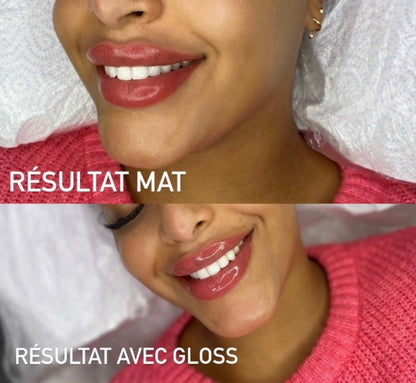 Pack Lips expert 2 en 1 : Dark lips et Blush Lips + kit inclus sur place ( 2 jours )