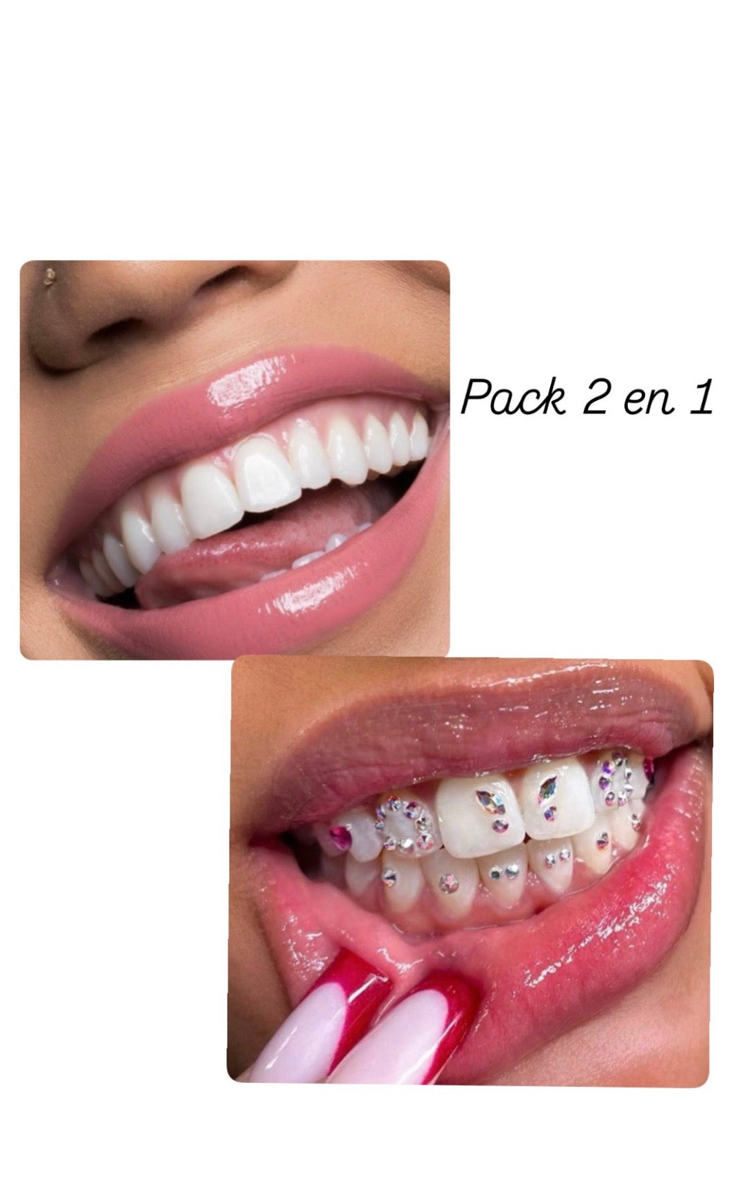 Pack 2 en 1 : formation blanchiment dentaire et strass dentaire + kit inclus sur place (1 jour)