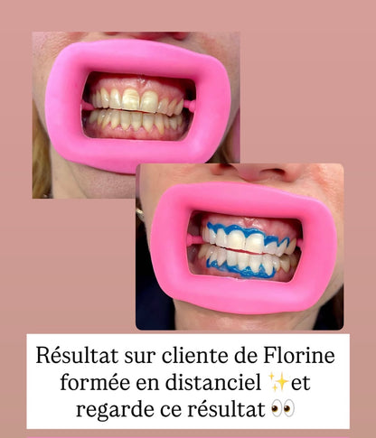 Pack 2 en 1 : blanchiment dentaire et strass dentaire + kit inclus (à distance )