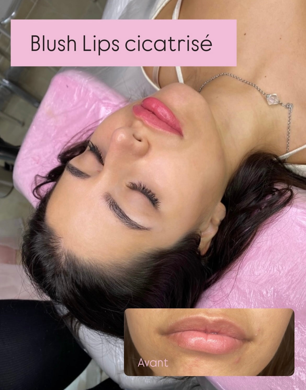 Pack Lips expert 2 en 1 : Dark lips et Blush Lips + kit inclus sur place ( 2 jours )