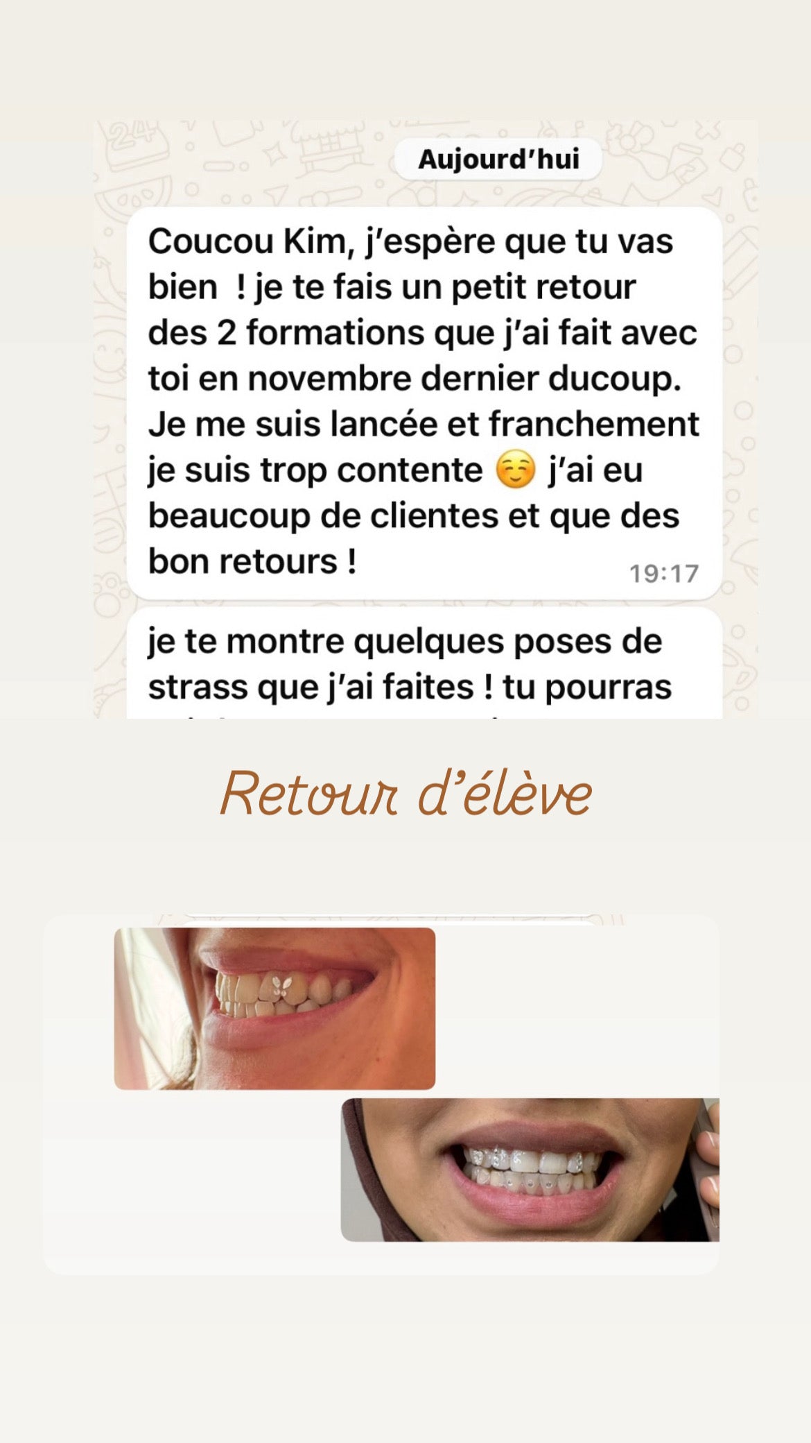 Pack 2 en 1 : blanchiment dentaire et strass dentaire + kit inclus (à distance )