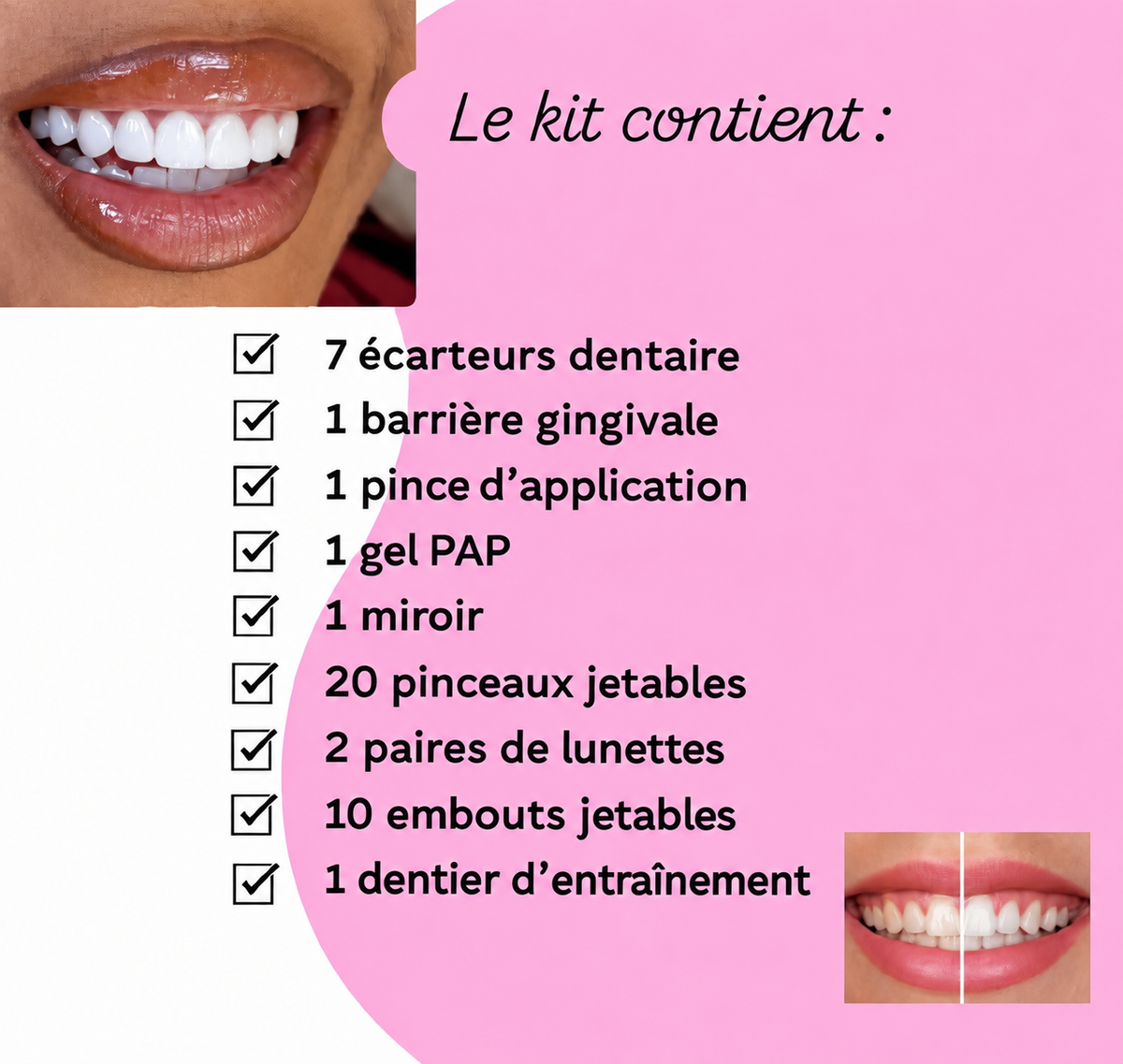 blanchiment dentaire + kit inclus (sur place)