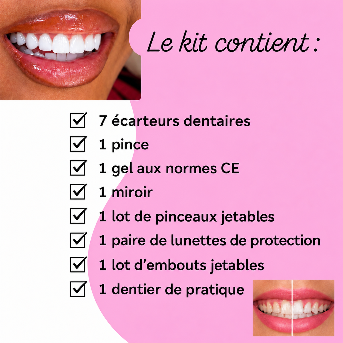 blanchiment dentaire + kit inclus ( à distance)