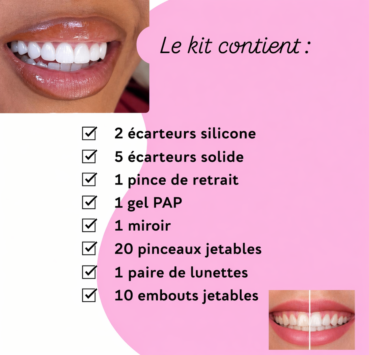 blanchiment dentaire + kit inclus sur place (1 jour)
